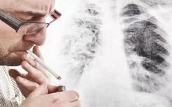 戒烟后发生肺癌的概率是正常人的三倍？警惕肺癌三大危险信号