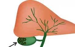 乙型肝炎容易变成肝硬化肝癌,如何诊断乙型肝炎？