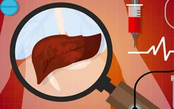 脂肪肝最好的中药处方是什么？轻度脂肪肝能自愈吗