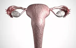 子宫内膜癌会出现什么症状?子宫出血就是子宫内膜癌吗？