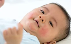 小孩感冒咳嗽流鼻涕怎么办？如何预防宝宝感冒咳嗽的发生？