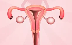 子宫内膜异位症妊娠分娩能治疗吗？