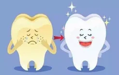 目前最火的牙齿美白手段 牙医才懂的牙齿美白利与弊