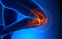 运动损伤膝盖怎么恢复